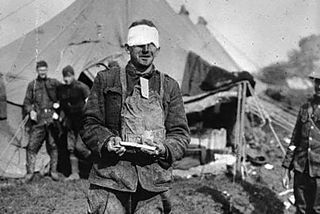 american wounded chocolate war battle