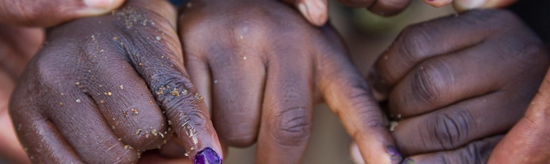 africa polio free
